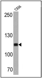 CD43 Antibody in Western Blot (WB)