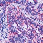 TIMP2 Antibody in Immunohistochemistry (Paraffin) (IHC (P))