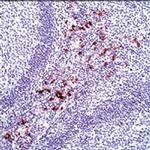 Calprotectin Antibody in Immunohistochemistry (Paraffin) (IHC (P))