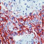 Mesothelioma Antibody in Immunohistochemistry (Paraffin) (IHC (P))