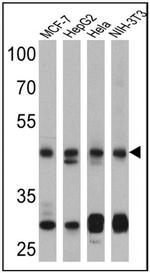 PTEN Antibody in Western Blot (WB)