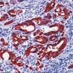 Cytokeratin 19 Antibody in Immunohistochemistry (Paraffin) (IHC (P))