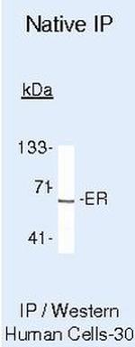 Estrogen Receptor alpha Antibody in Immunoprecipitation (IP)