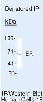 Estrogen Receptor alpha Antibody in Immunoprecipitation (IP)