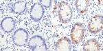 MUC2 Monoclonal Antibody (996/1)