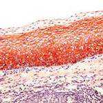 P-cadherin Antibody in Immunohistochemistry (IHC)