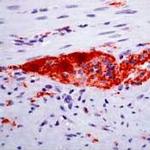 PGP9.5 Antibody in Immunohistochemistry (Paraffin) (IHC (P))