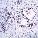 Maspin Antibody in Immunohistochemistry (IHC)