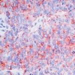 CA125 Antibody in Immunohistochemistry (IHC)