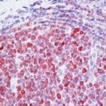 TOP2A Antibody in Immunohistochemistry (IHC)