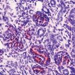 WT1 Antibody in Immunohistochemistry (IHC)