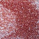 CD45RA Antibody in Immunohistochemistry (Paraffin) (IHC (P))