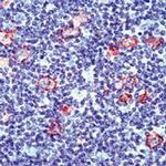 CD30 Antibody in Immunohistochemistry (Paraffin) (IHC (P))