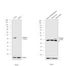 Calretinin Antibody in Western Blot (WB)