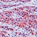 Calretinin Antibody in Immunohistochemistry (Paraffin) (IHC (P))
