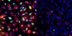 p53 Antibody in Immunocytochemistry (ICC/IF)