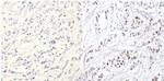 p53 Antibody in Immunohistochemistry (Paraffin) (IHC (P))