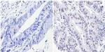 p53 Antibody in Immunohistochemistry (Paraffin) (IHC (P))