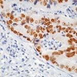 p53 Antibody in Immunohistochemistry (Paraffin) (IHC (P))