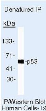 p53 Antibody in Immunoprecipitation (IP)