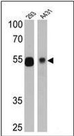 p53 Antibody in Western Blot (WB)