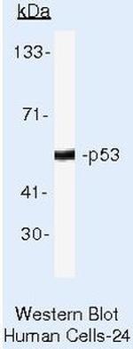 p53 Antibody in Western Blot (WB)