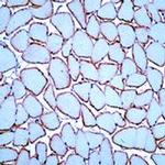 Dysferlin Antibody in Immunohistochemistry (IHC)