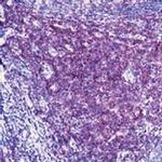 CD3 Antibody in Immunohistochemistry (Paraffin) (IHC (P))