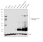 Progesterone Receptor Antibody