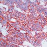 EpCAM Antibody in Immunohistochemistry (Paraffin) (IHC (P))