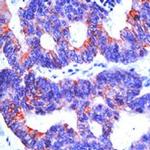 Cytokeratin 19 Antibody in Immunohistochemistry (IHC)