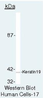 Cytokeratin 19 Antibody in Western Blot (WB)
