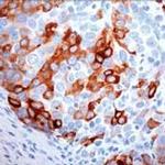 Mammaglobin A Antibody in Immunohistochemistry (IHC)