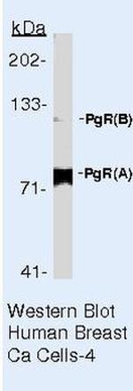 Progesterone Receptor Antibody in Western Blot (WB)