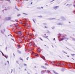 TFF1 Antibody in Immunohistochemistry (Paraffin) (IHC (P))