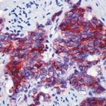 CD56 Antibody in Immunohistochemistry (IHC)