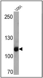 CD56 Antibody in Western Blot (WB)