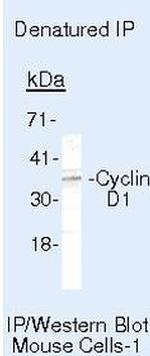 Cyclin D1 Antibody in Immunoprecipitation (IP)