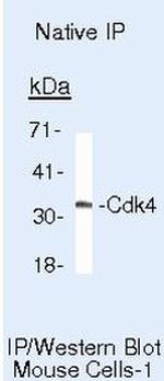 Cyclin D1 Antibody in Immunoprecipitation (IP)