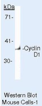 Cyclin D1 Antibody in Western Blot (WB)