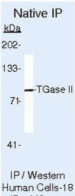 TGM2 Antibody in Immunoprecipitation (IP)