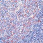 HDJ2 Antibody in Immunohistochemistry (Paraffin) (IHC (P))