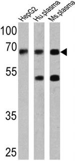 AFP Antibody in Western Blot (WB)