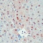 SULT1E1 Antibody in Immunohistochemistry (IHC)