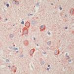 MAP1B Antibody in Immunohistochemistry (Paraffin) (IHC (P))