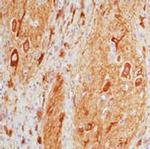 MAP2 Antibody in Immunohistochemistry (Paraffin) (IHC (P))