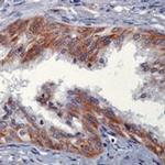 NRG1 Antibody in Immunohistochemistry (IHC)