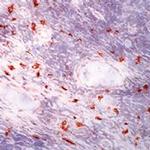 c-Kit Antibody in Immunohistochemistry (Frozen) (IHC (F))