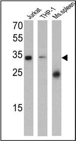 CD99 Antibody in Western Blot (WB)