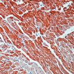 Cardiac Troponin T Antibody in Immunohistochemistry (Paraffin) (IHC (P))